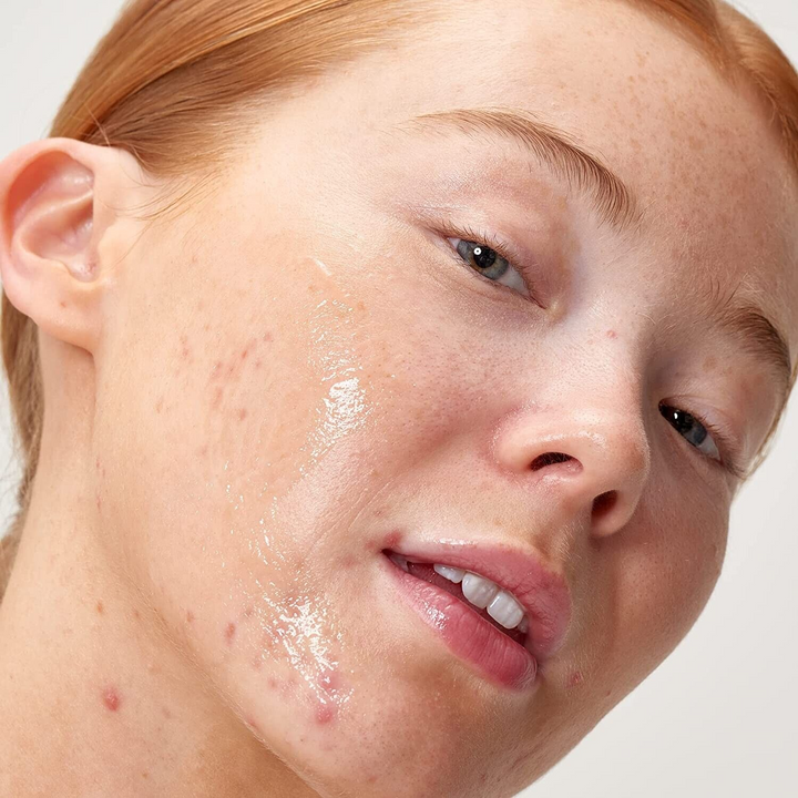 Inkey 30ml Apple Cider Vinegar Peel