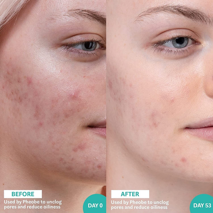 Selfless 30ml Salicylic Acid Sea Kelp Serum