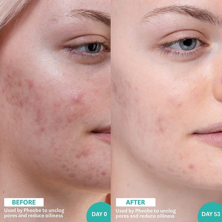 Selfless 30ml Salicylic Acid Sea Kelp Serum